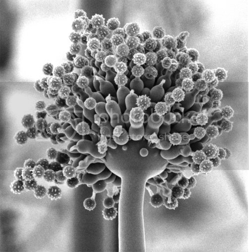 Hướng dẫn chẩn đoán và điều trị nhiễm nấm xâm lấn